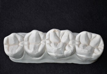 Maxillary premolars and molars in white plaster on a dark background