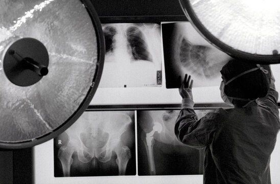A nurse handles X-Rays on a light table.