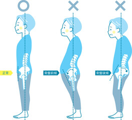 シニア男性の良い姿勢と悪い姿勢の見本_骨盤