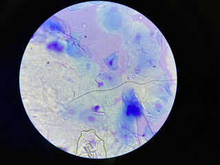 Microscopic view of Malassezia pachydermatis cells taken from dog with ear infecion