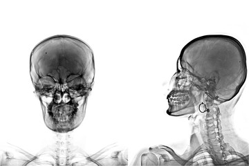 skull x ray isolated on white background