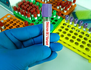 Blood sample for Omicron BF.7 variant test. New variant of the SARS-CoV-2 coronavirus. Subvariant...