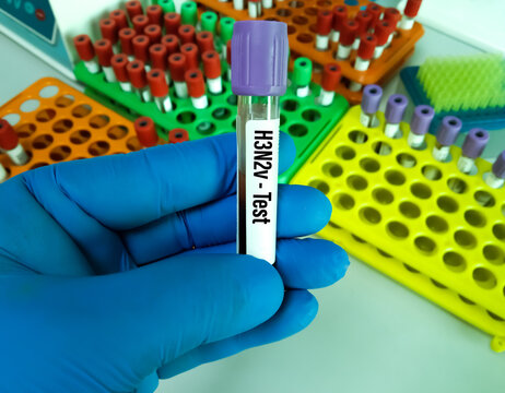 Blood sample for Influenza A H3N2 variant viruses (also known as “H3N2v” viruses) test