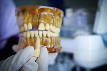 Dentist holding an artificial lower jaw. Dental Prosthesis. tooth plate. Dental Model medical object for teaching student in dental care school