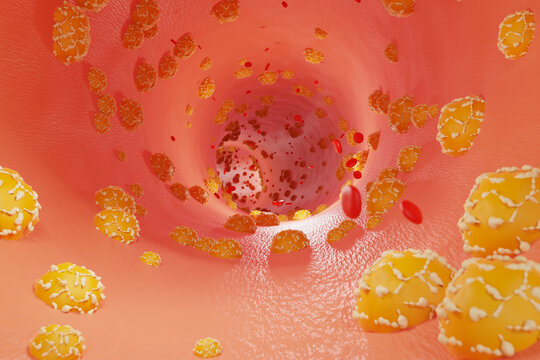 Hyperlipidemia concept. Fat deposits in blood vessels and red blood cell flow. Health care and medical. 3d render.
