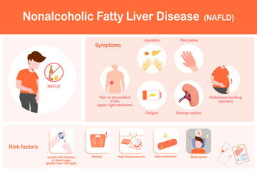 Vector illustration of non-alcoholic fatty liver disease (NAFLD), symptoms and risk factors in flat style. - obrazy, fototapety, plakaty