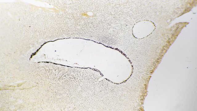 Cholangiole of the human being in section filmed under microscope 40x on white background. Isolated macro view of intrahepatic bile ducts. Investigation of people anatomy held in biological laboratory
