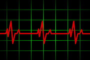 Vector illustration of heart rate and pulse graph