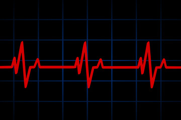 Vector illustration of heart rate and pulse graph	