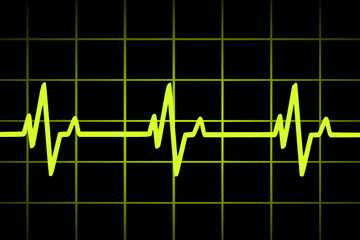 Vector illustration of heart rate and pulse graph	