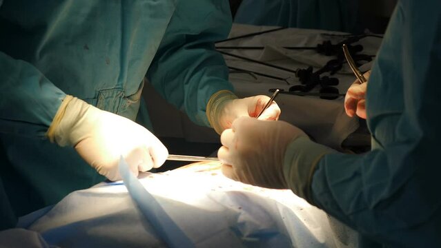 Surgeon sews wound after surgery using self-absorbable threads, hands closeup. Surgical needle in doctor hands. Sterile medical instruments in hospital. Healthcare concept. Abdominal surgery with neat