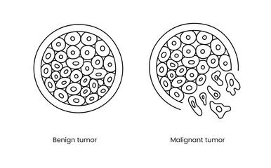 Benign and malignant tumor line icon in vector, illustration of oncology.