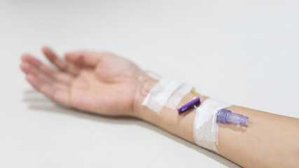 Arm puncture for intravenous infusion or medication for hospitalized patients, Treatment of patients with intravenous injections to allow the patient to receive the drug directly.