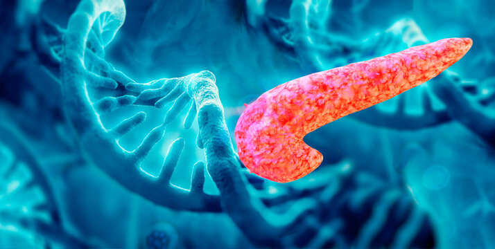 Treatment of Pancreatic Cancer, DNA vaccine