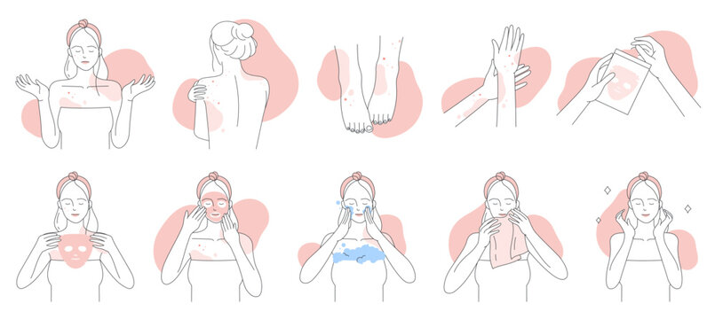 Allergy, Symptoms And Treatment Line Icons Set Vector Illustration. Hand Drawn Girls Suffer From Allergic Dermatitis And Skin Atopy, Apply Facial Mask To Care Itchy Sensitive Skin With Irritation