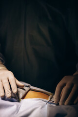 Obraz premium Surgeon doing operation at hospital using medical equipment