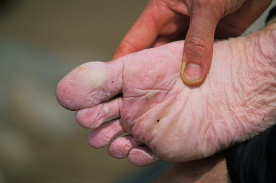 Man massages his waterlogged foot during / after an adventure race.
