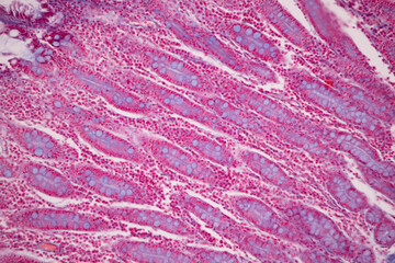 Fototapeta na wymiar Tissue of Small intestine (Duodenum), Large intestine Human and Stomach Human under the microscope in Lab.