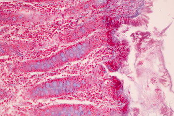 Tissue of Small intestine (Duodenum), Large intestine Human and Stomach Human under the microscope in Lab.