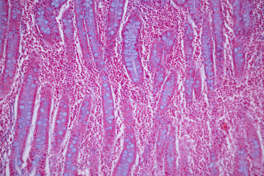 Tissue of Small intestine (Duodenum), Large intestine Human and Stomach Human under the microscope in Lab.