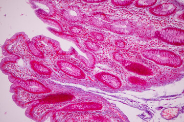 Tissue of Small intestine (Duodenum), Large intestine Human and Stomach Human under the microscope in Lab.