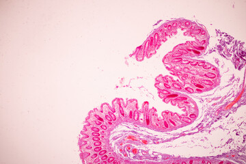 Tissue of Small intestine (Duodenum), Large intestine Human and Stomach Human under the microscope in Lab.