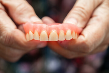 Asian senior or elderly old woman patient holding to use denture in nursing hospital ward, healthy strong medical concept.