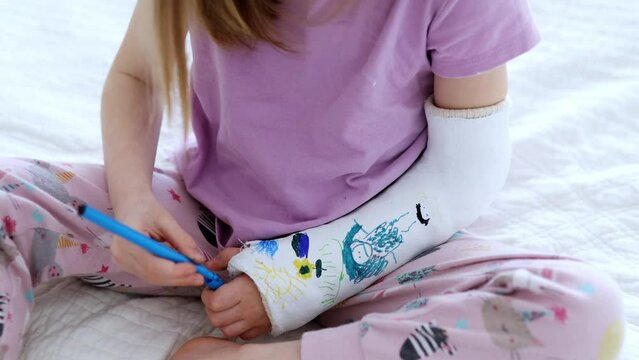 Adorable preschooler girl with a broken arm at home on the bed draws with felt-tip pens on an orthopedic cast. How to have fun with a broken limb. Broken arm in a cast in kids