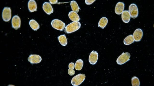 Trochophore larvae under a microscope, possibly at stage of parenchymella from phylum Porifera. Sample was collected in the middle of June in White Sea.