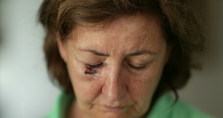 Older woman with bruise scar face opening eyes looking to camera