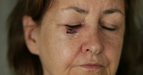 Fototapeta premium Older woman with healing scar after surgery