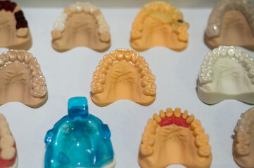 Plaster casts of the jaws. Variety of samples in the prosthetic workshop. 