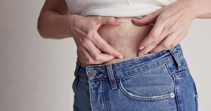 Stomach Fat Liposuction And Diet