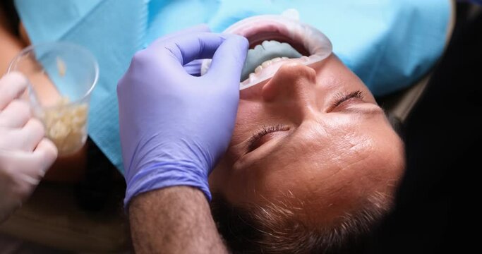 Dentist takes out cotton swab after dental treatment