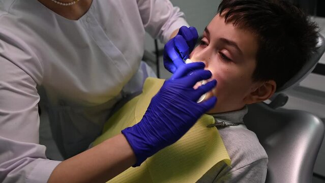 Close-up of female dentist putting on a retractor in the child's mouth, before treating teeth in dental clinic. Pediatric dentistry. Dental practice. Curing caries. Teen boy at dentist's appointment