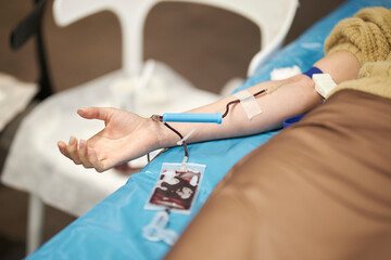 The doctor takes blood from the patient. Blood donation. Donation 