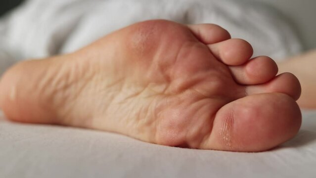 Person's leg sticking out from under blanket. Female barefoot close-up with dry calluses and corns. Tracking left shot