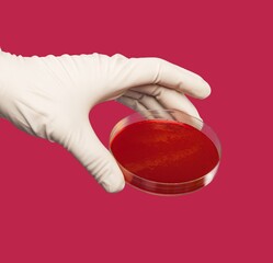 Sample culture microorganisms in Petri dish