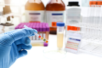 Urine and universal indicator paper, Litmus Paper of ph Value Measurement