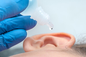 CLOSEUP OF DOCTOR HAND DRIPPING EAR DROPS IN THE PATIENT EAR WITH DROPPER. TREATMENT FOR EARACHE,...