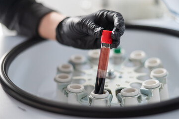 The doctor takes out a test tube with blood plasma from the centrifuge. Plasma lifting procedure...