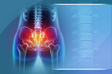 Hip painful skeleton x-ray. Medical concept. 3d illustration - obrazy, fototapety, plakaty