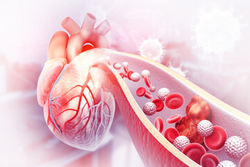 Cholesterol blocked artery with heart. A blood clot in the vessels of the human heart. 3d illustration