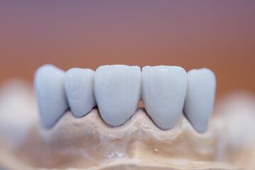 Close up tooth model / mock tooth in dental clinic Dental care and dentist 's equipment concept