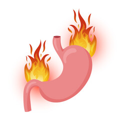 Burning human stomach, flame is outside stomach. Vector illustration, cartoon style, white background
