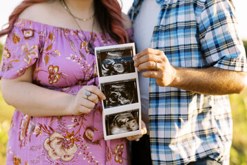 Couple holding ultrasound picture 