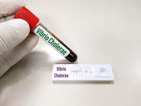 Vibrio Bilder Durchsuchen 1,881 Archivfotos, und