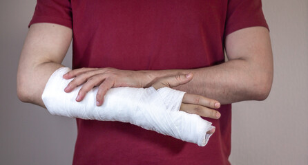 Broken arm, fingers. A white man in a red T-shirt with a cast on his arm.