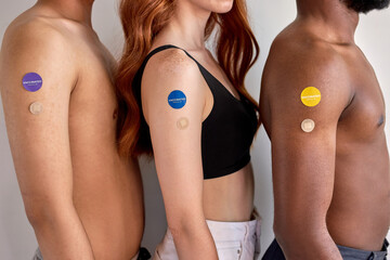 close-up half-naked diverse people showing arm after vaccine injection, standing in row....