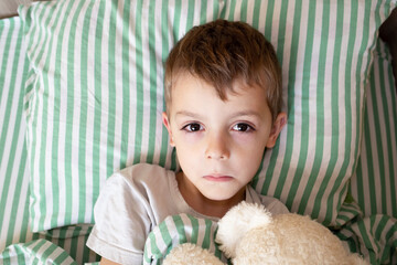 Unhealthy little boy child sleep in bed relax at home in bedroom. Sick ill little kid suffer from flu fever asleep in bed on lockdown quarantine. portrait of a sick child